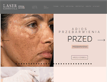 Tablet Screenshot of lasercosmetica.pl